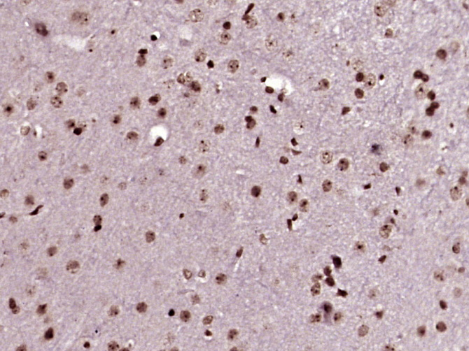 Rabbit anti-Phospho-TH(Ser31) Polyclonal Antibody