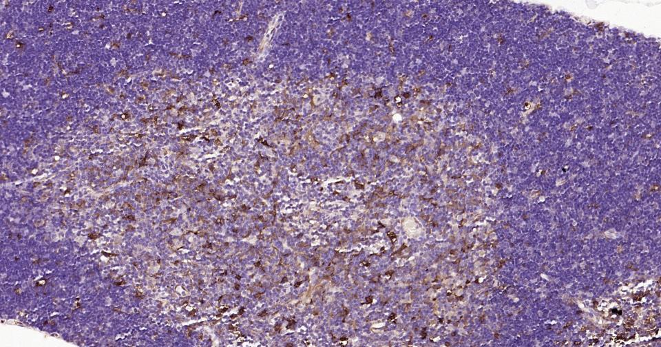 Rabbit anti-Galectin 3 Polyclonal Antibody