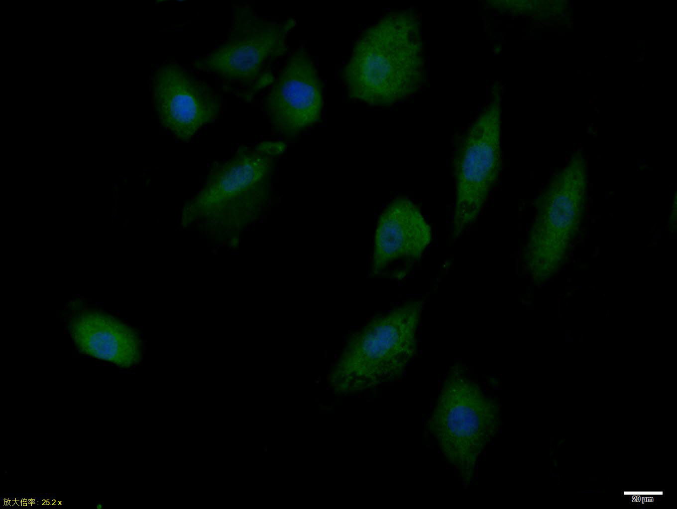 Rabbit anti-Phospho-IRS1(Tyr632) Polyclonal Antibody
