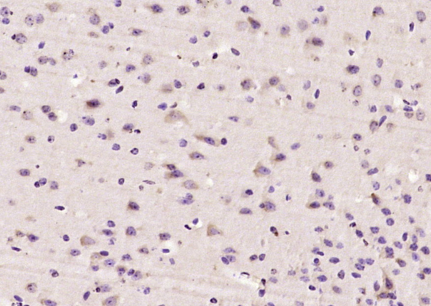 Rabbit anti-MADH7 Polyclonal Antibody