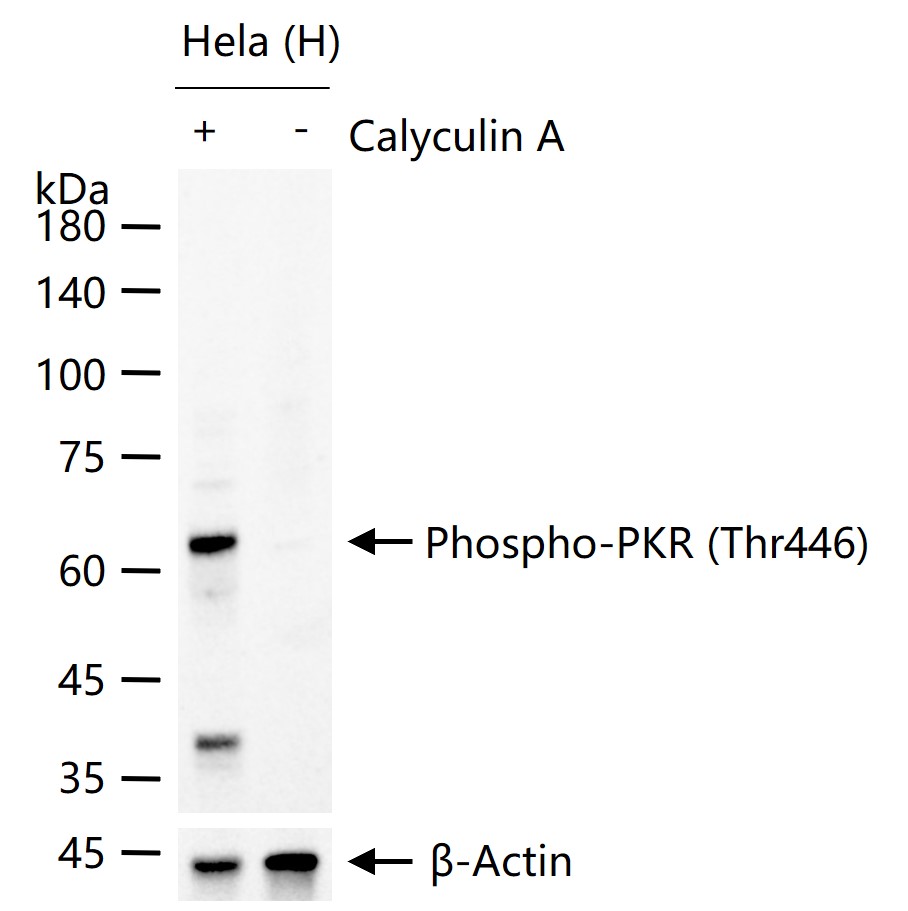 Rabbit anti-Phospho-PKR(Thr446) Monoclonal Antibody