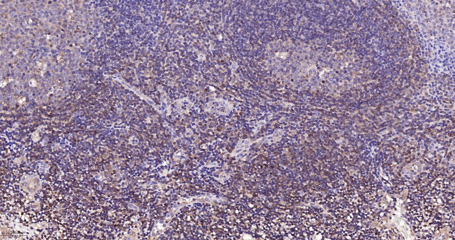Rabbit anti-NFKB p65 Monoclonal Antibody