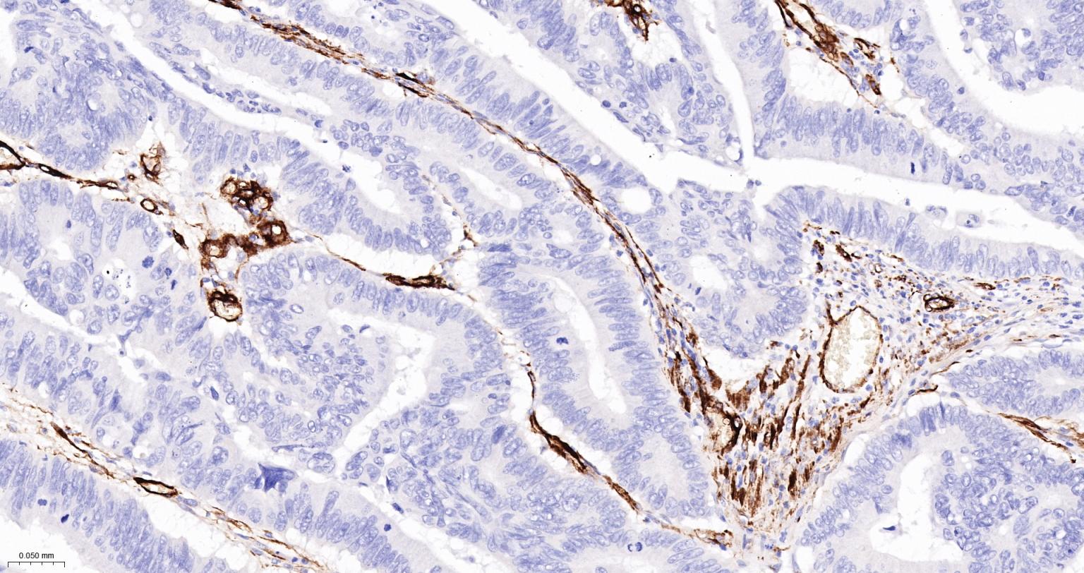 Rabbit anti-CD105 Polyclonal Antibody