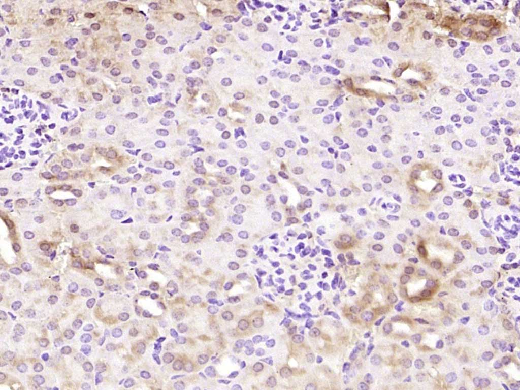 Rabbit anti-EDC4 Polyclonal Antibody