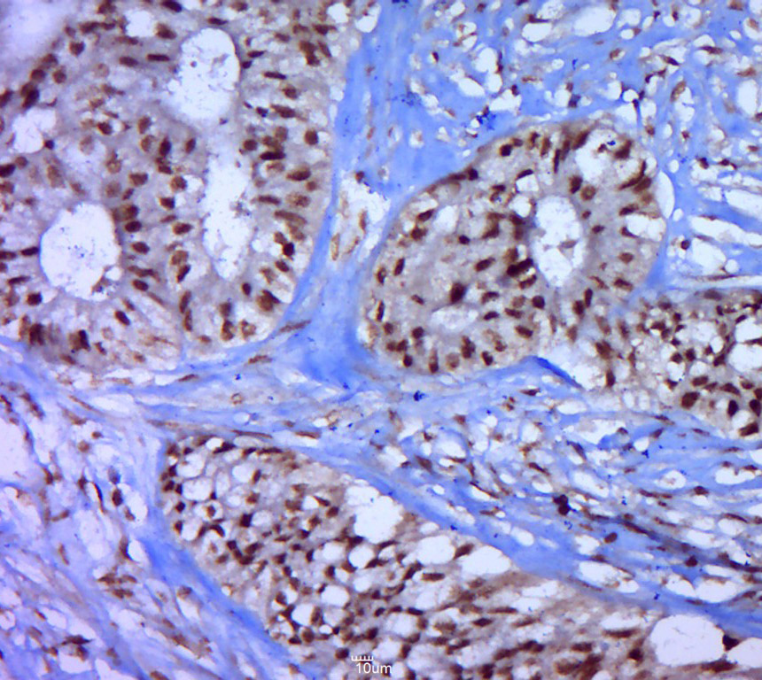 Rabbit anti-Phospho-P53(Thr55) Polyclonal Antibody