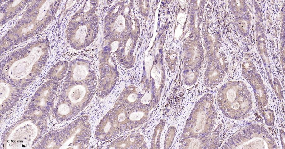 Rabbit anti-Phospho-PKR(Thr446) Monoclonal Antibody