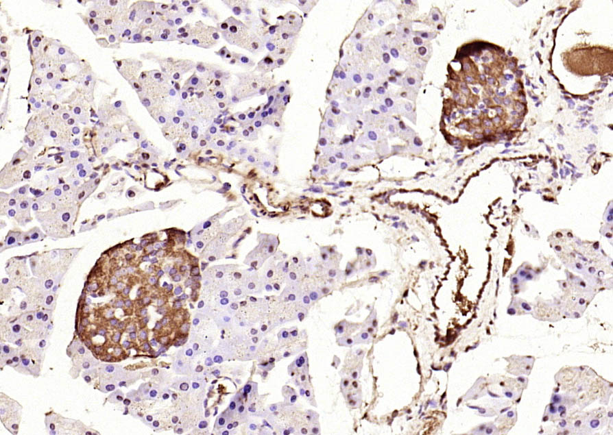 Rabbit anti-Phospho-IRS1(Tyr632) Polyclonal Antibody