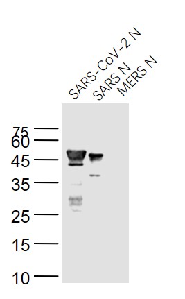 Mouse anti-SARS-CoV Nucleocapsid Monoclonal Antibody