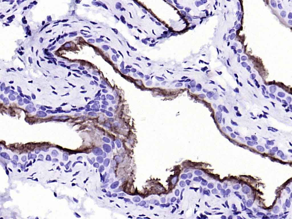 Rabbit anti-CK20 Monoclonal Antibody