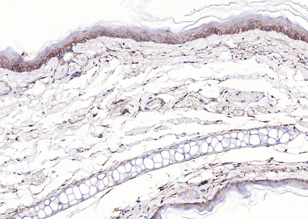 Rabbit anti-EGFR Polyclonal Antibody