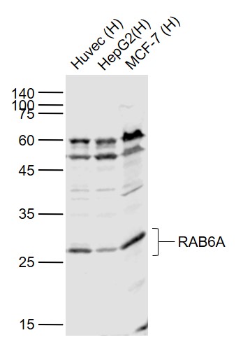 Rabbit anti-RAB6A Polyclonal Antibody