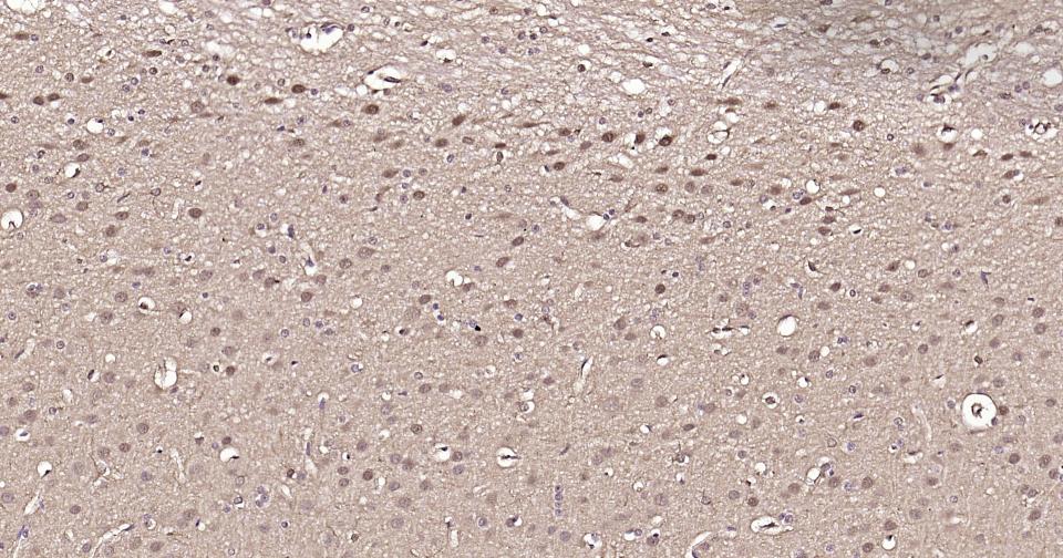 Rabbit anti-GAPDH Polyclonal Antibody