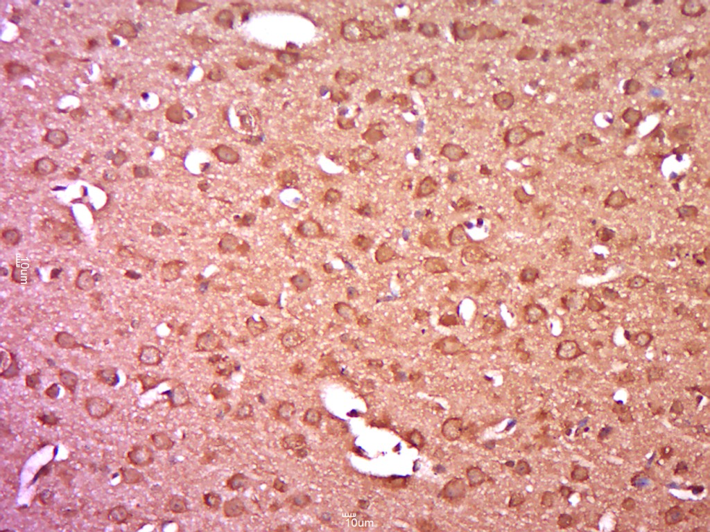 Rabbit anti-Phospho-PKC δ(Tyr52) Polyclonal Antibody