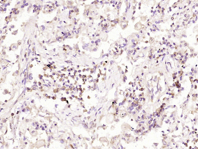 Mouse anti-Aquaporin 4  Monoclonal Antibody