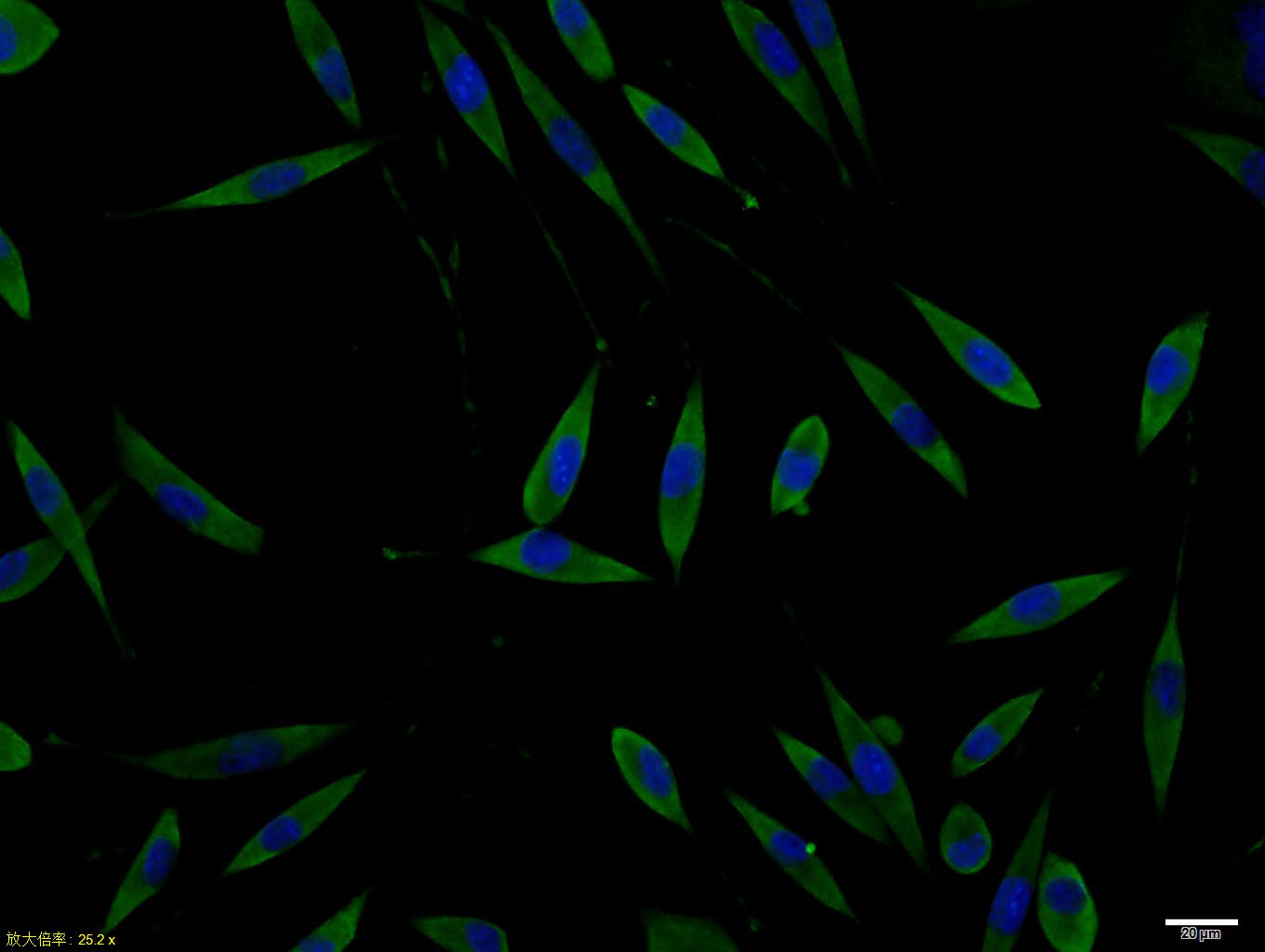 Rabbit anti-Phospho-Doublecortin(Ser128) Polyclonal Antibody