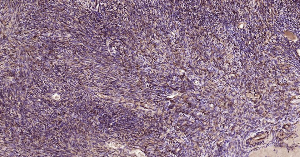 Rabbit anti-Galectin 3 Polyclonal Antibody