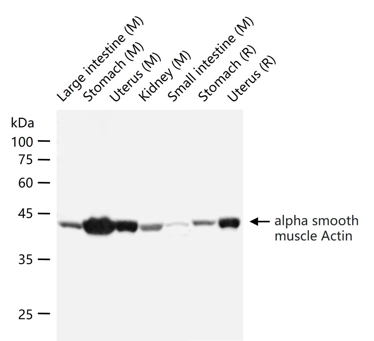 Rabbit anti-α Smooth Muscle Actin Monoclonal Antibody