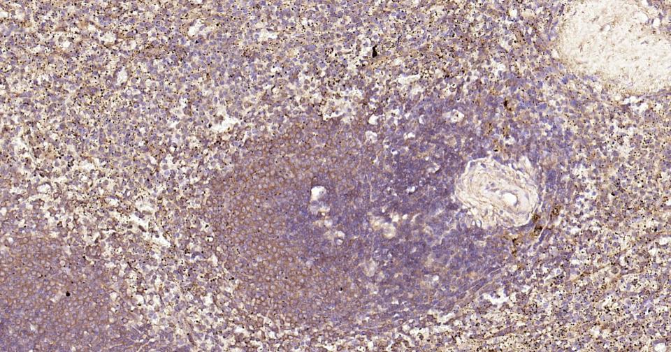 Rabbit anti-NFKB p65 Monoclonal Antibody