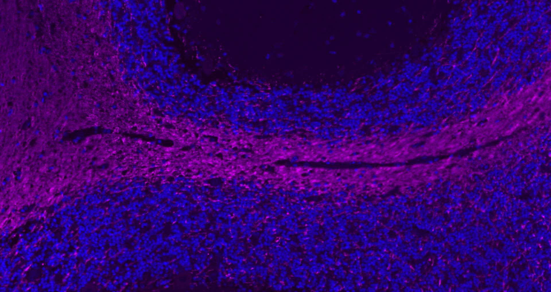 Rabbit anti-MBP Polyclonal Antibody