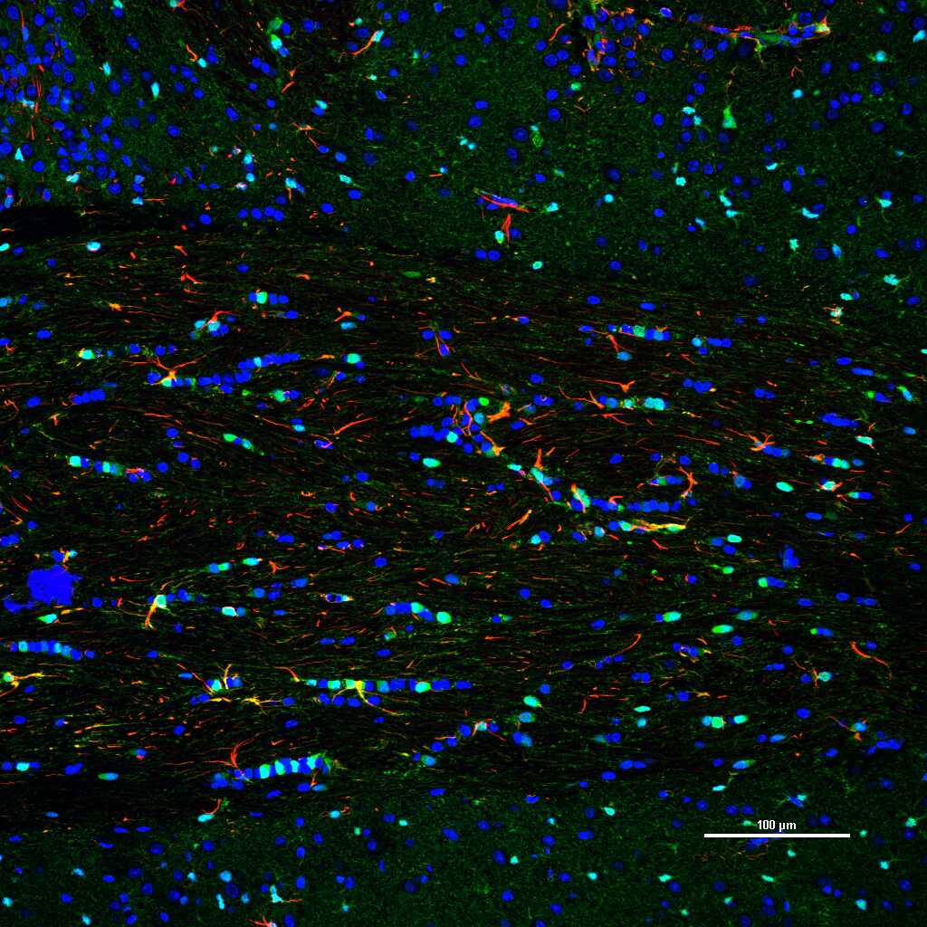 Mouse anti-S100B Monoclonal Antibody