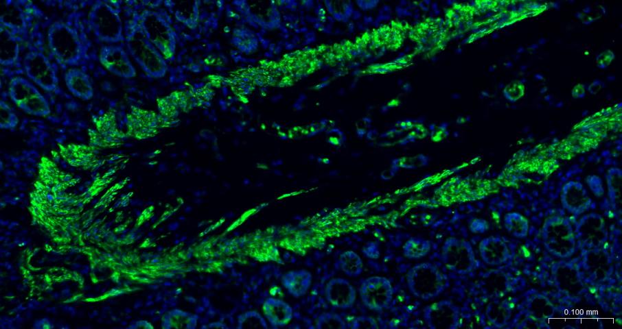 Rabbit anti-α Smooth Muscle Actin Monoclonal Antibody