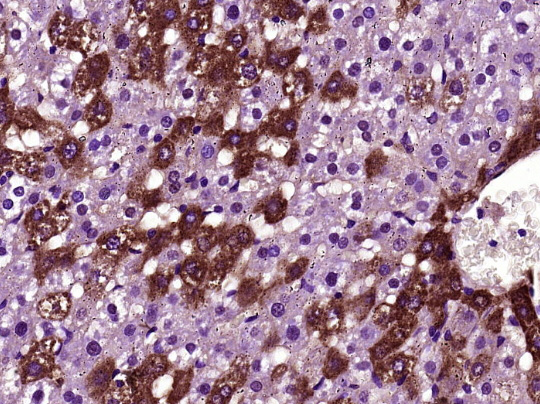 Rabbit Anti-BTBD17 Polyclonal Antibody