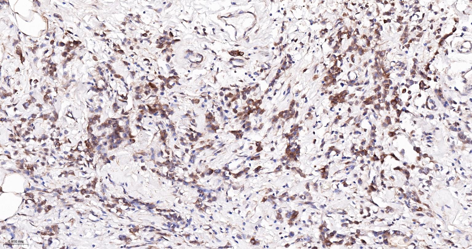 Rabbit anti-NFKB p65 Monoclonal Antibody