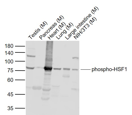 Rabbit anti-Phospho-HSF1(Ser307) Polyclonal Antibody