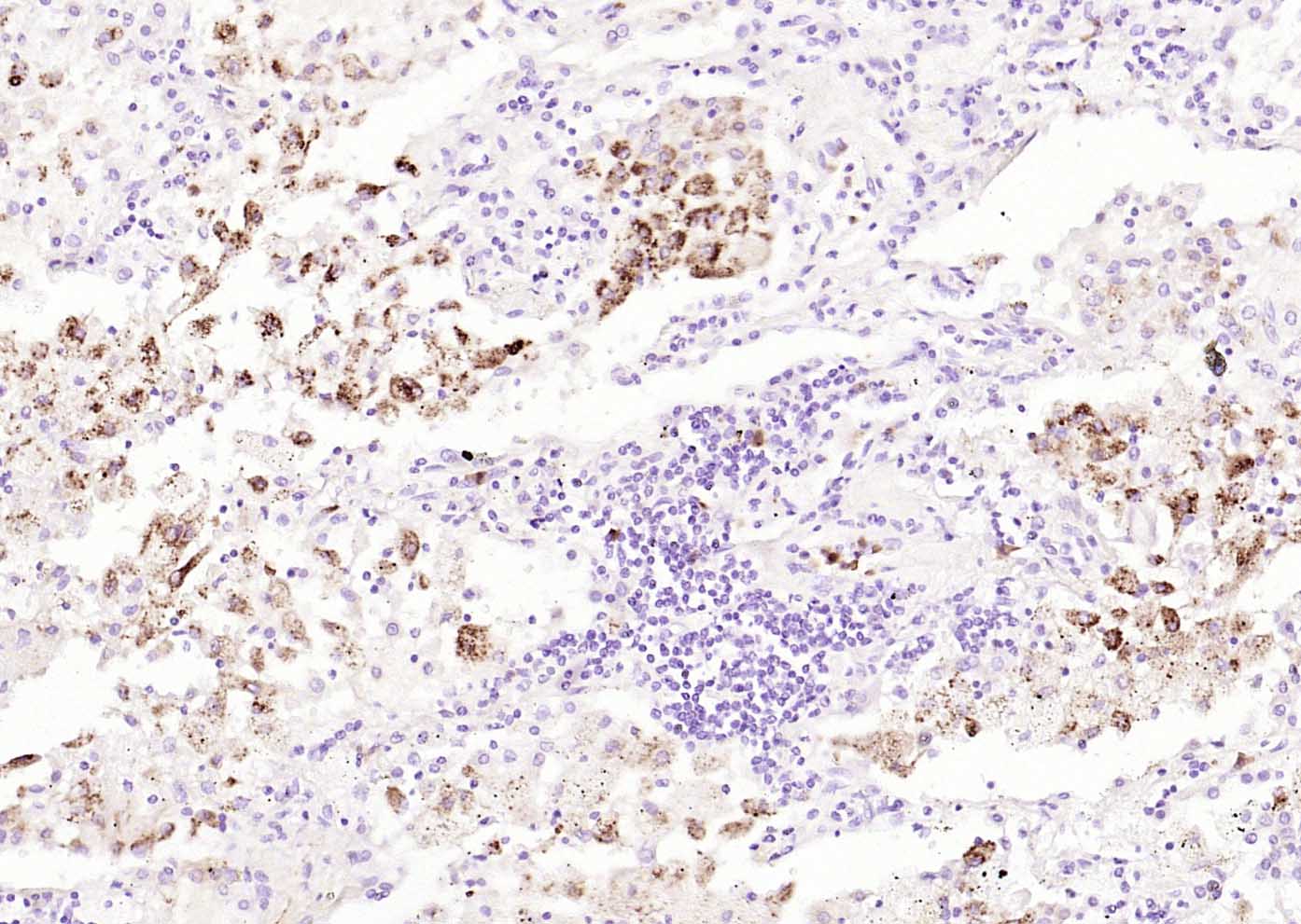 Rabbit Anti-MARCH6 Polyclonal Antibody