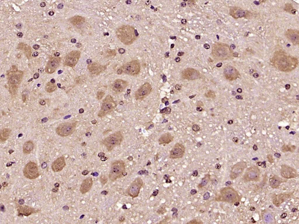 Rabbit anti-BTBD19 Polyclonal Antibody