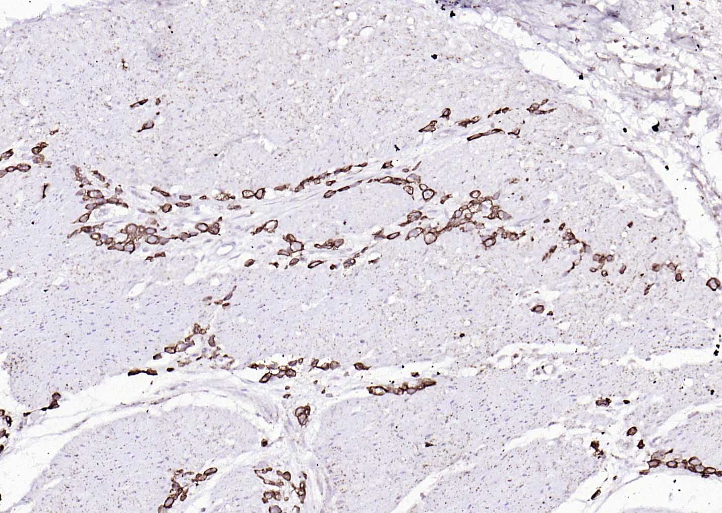 Mouse anti-Cytokeratin 8 Monoclonal Antibody