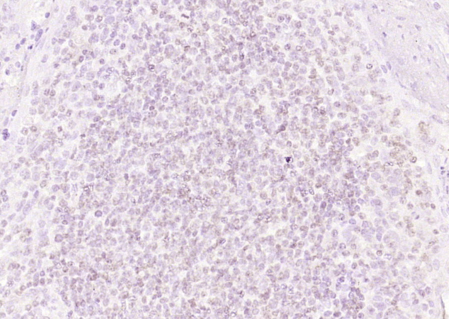 Rabbit Anti-LRRC41 Polyclonal Antibody