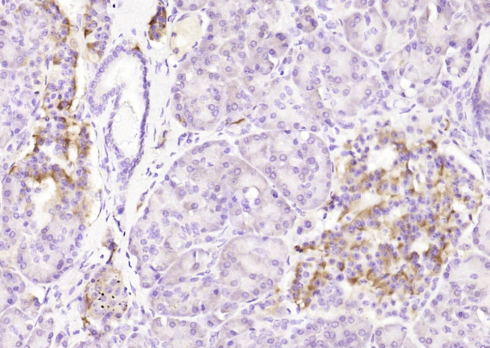 Rabbit anti-Phospho-Bcl-2(Ser70) Polyclonal Antibody