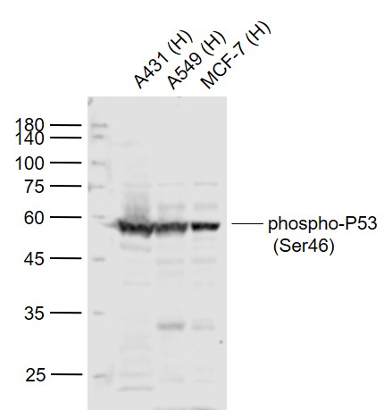 Rabbit anti-Phospho-P53(Ser46) Polyclonal Antibody