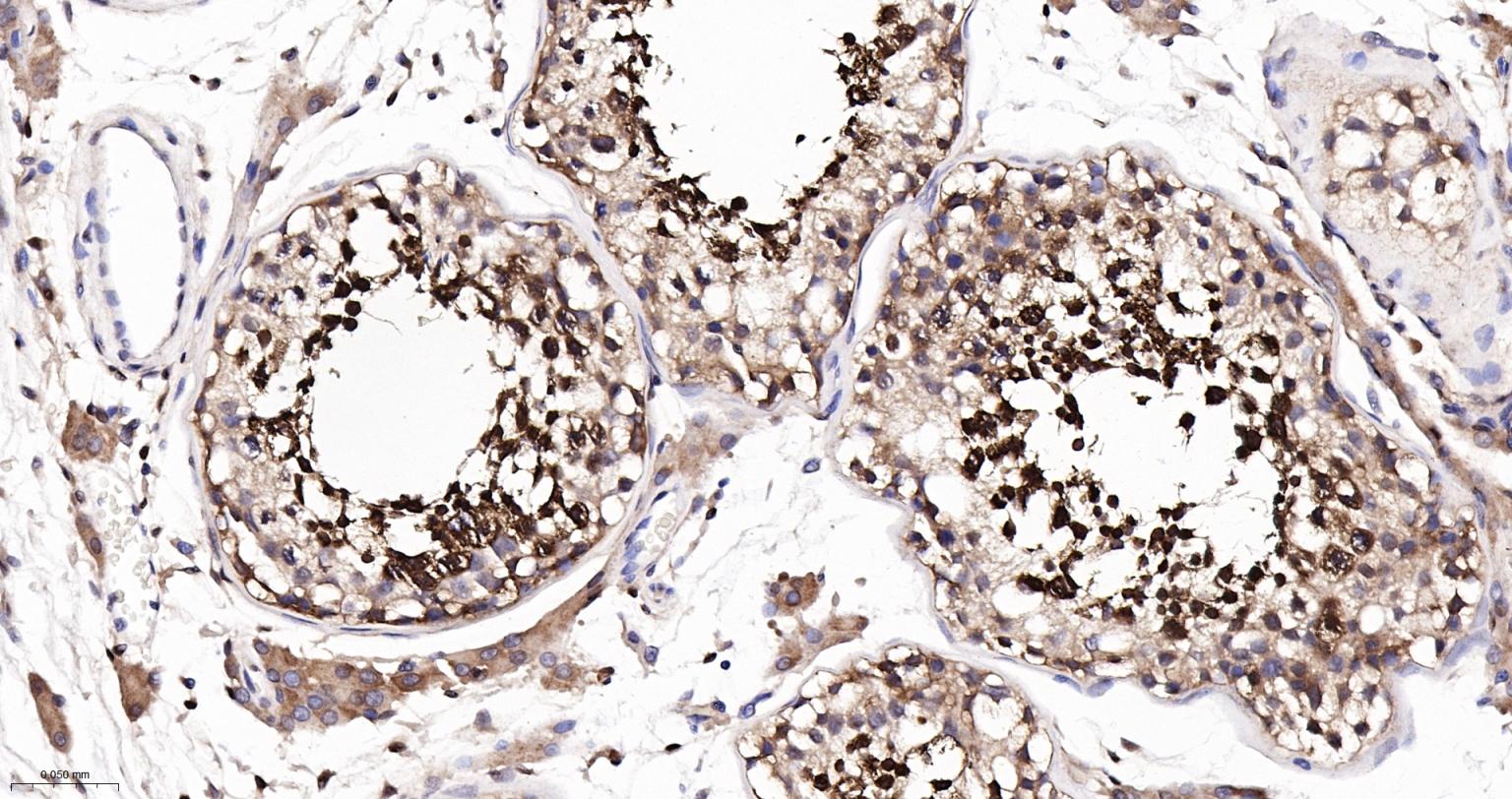 Rabbit anti-HSP70 Monoclonal Antibody