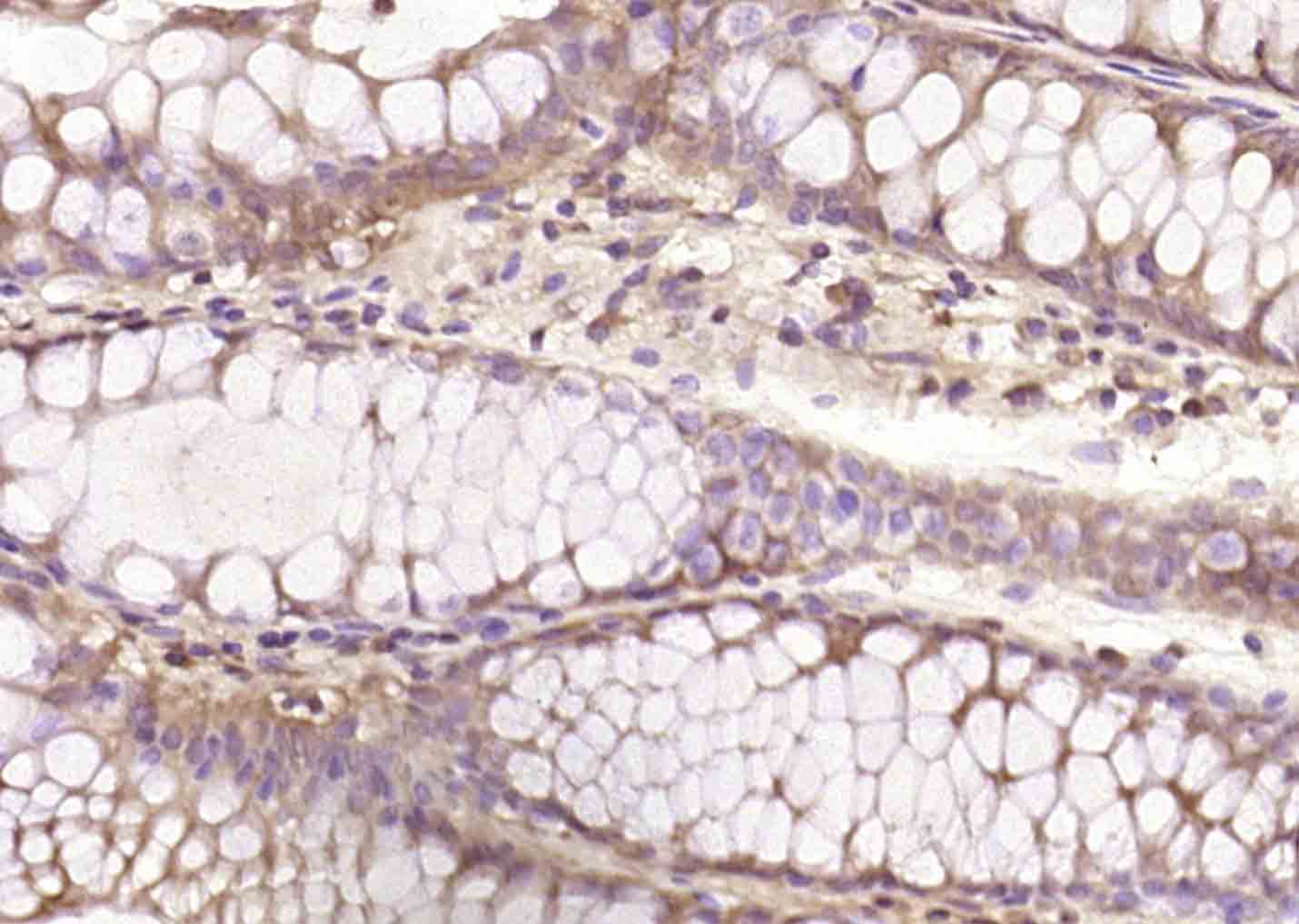 Rabbit anti-Phospho-Bcl-2(Ser70) Polyclonal Antibody