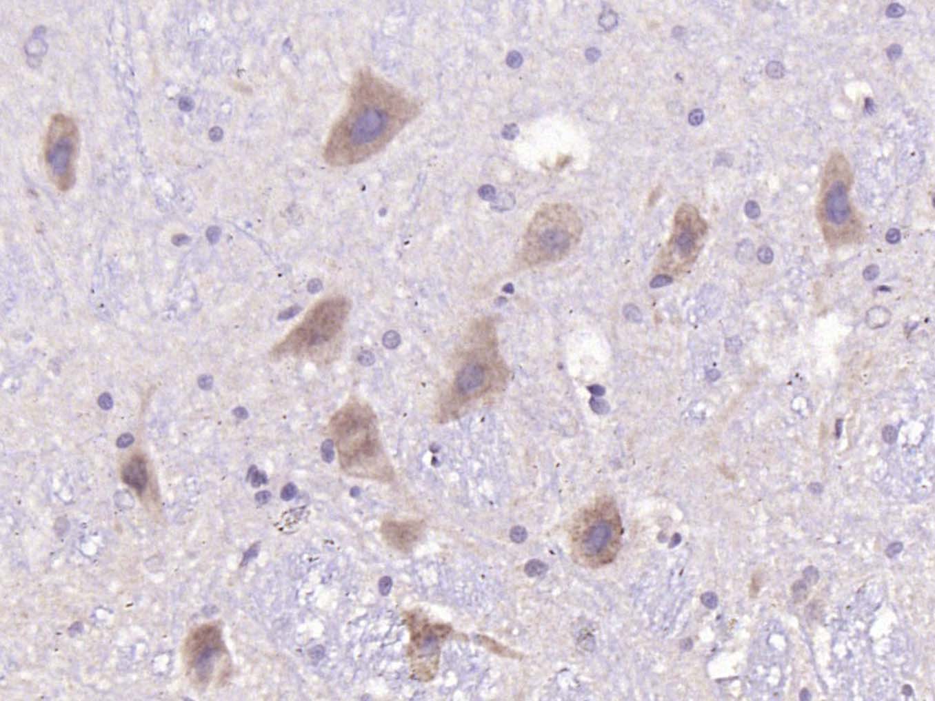 Rabbit anti-PMCA3 Polyclonal Antibody