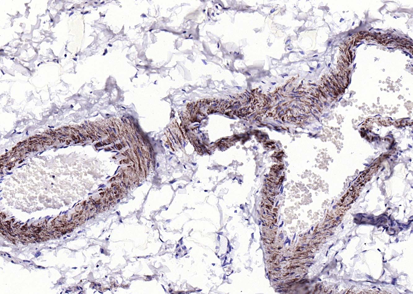 Rabbit anti-α Smooth Muscle Actin Polyclonal Antibody