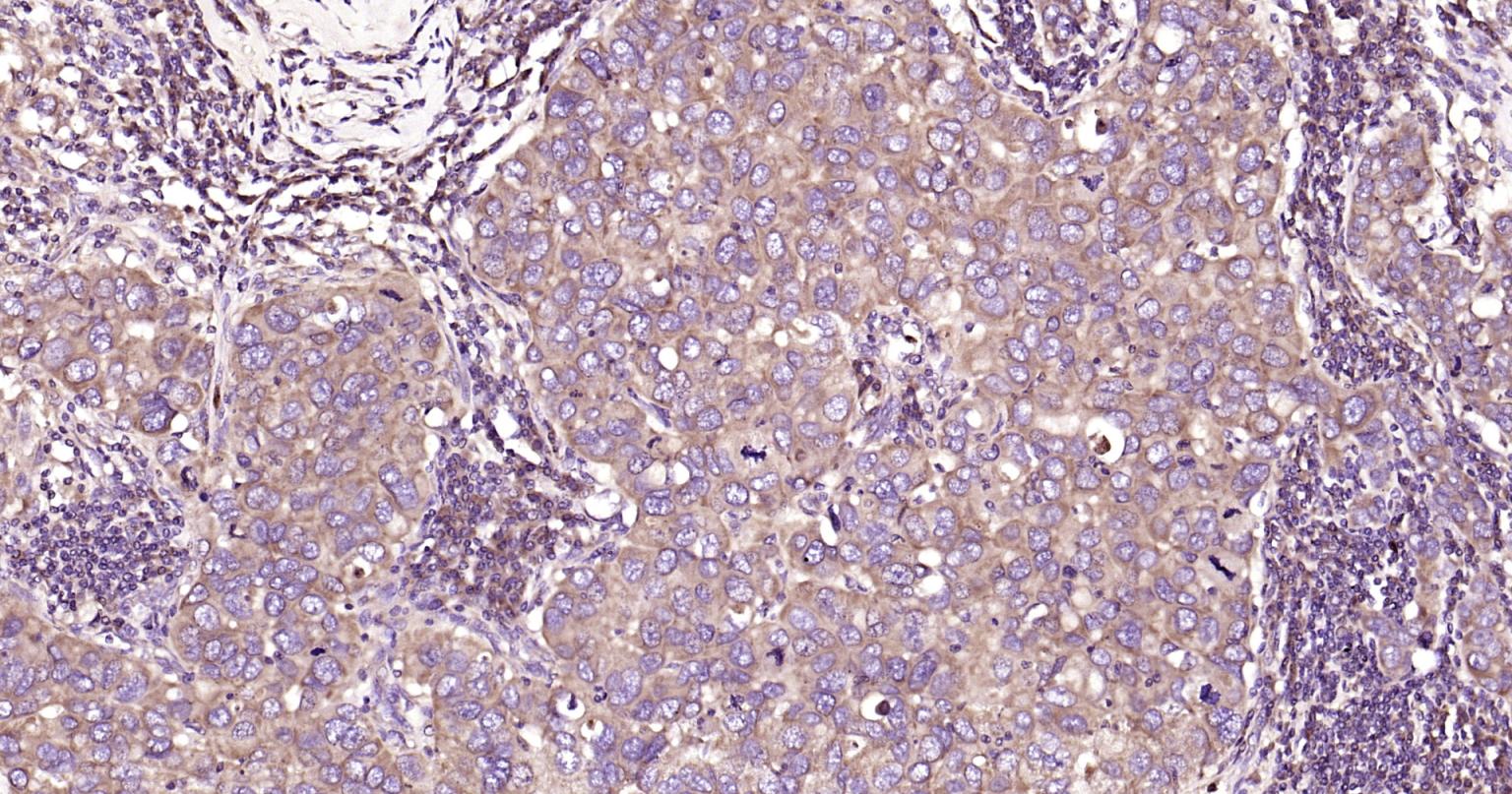 Rabbit anti-Beclin 1 Polyclonal Antibody