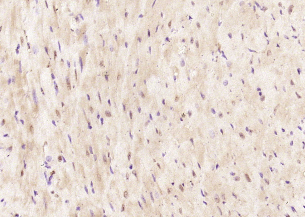 Rabbit Anti-LRRC2 Polyclonal Antibody
