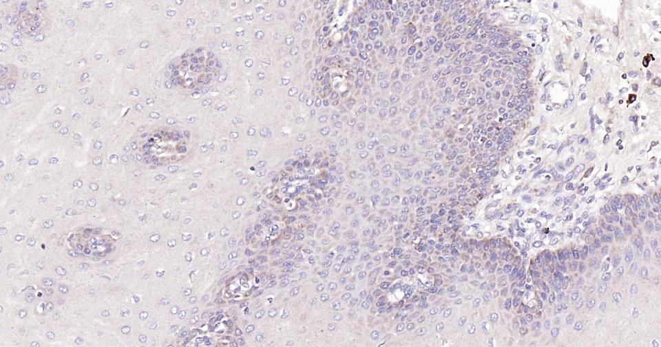 Rabbit anti-Bax Monoclonal Antibody