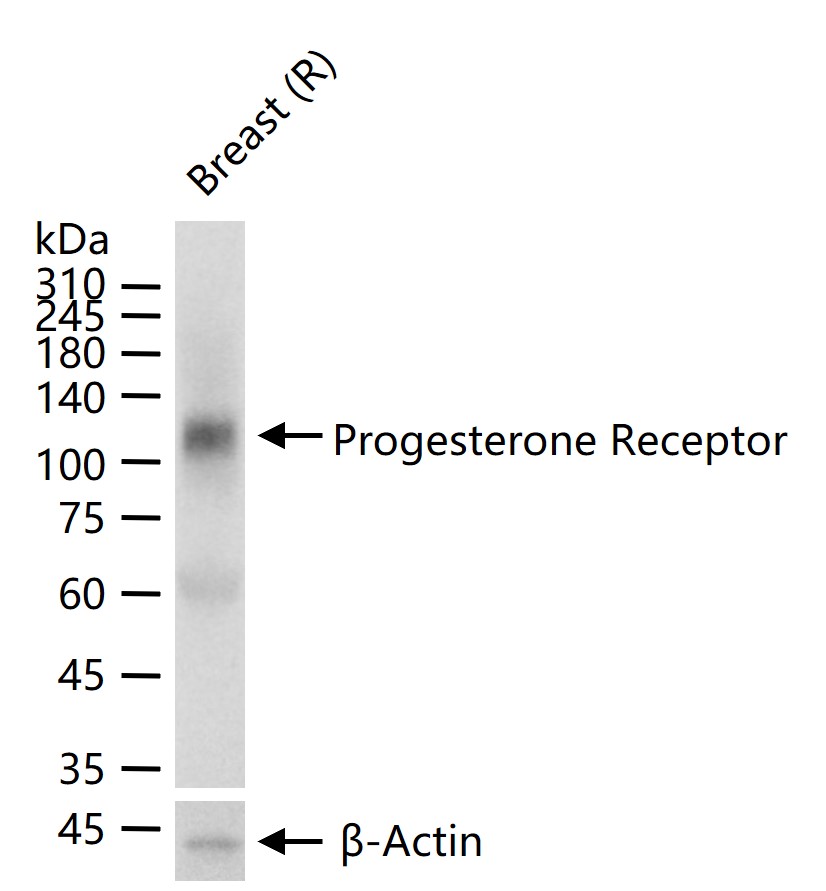 Rabbit anti-Progesterone Receptor Polyclonal Antibody