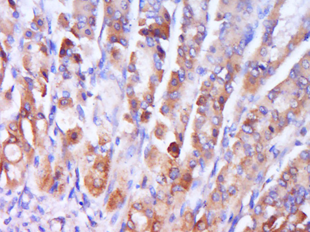Rabbit anti-Phospho-P38 MAPK(Thr180) Polyclonal Antibody