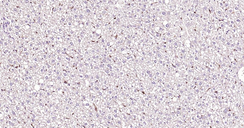 Rabbit anti-Galectin 3 Polyclonal Antibody