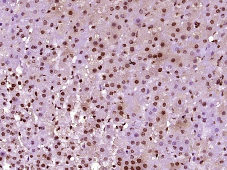 Rabbit anti-Phospho-TH(Ser31) Polyclonal Antibody