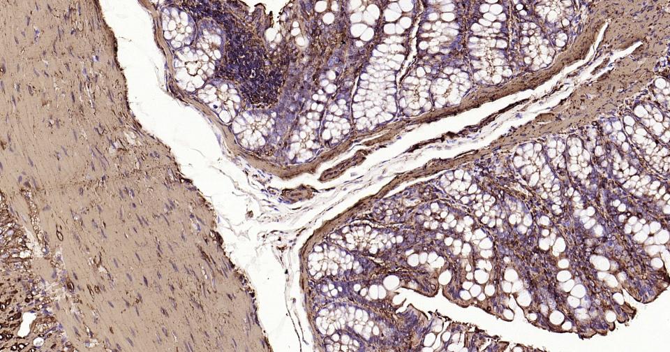 Rabbit anti-α Smooth Muscle Actin Monoclonal Antibody