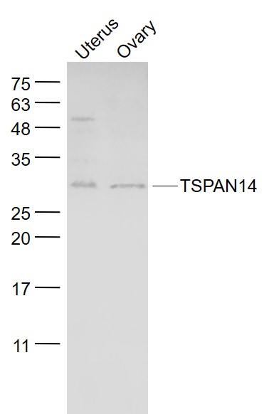 Rabbit anti-TSPAN14 Polyclonal Antibody