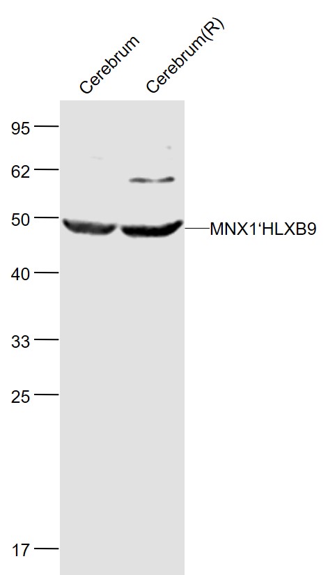 Rabbit anti-MNX1 Polyclonal Antibody
