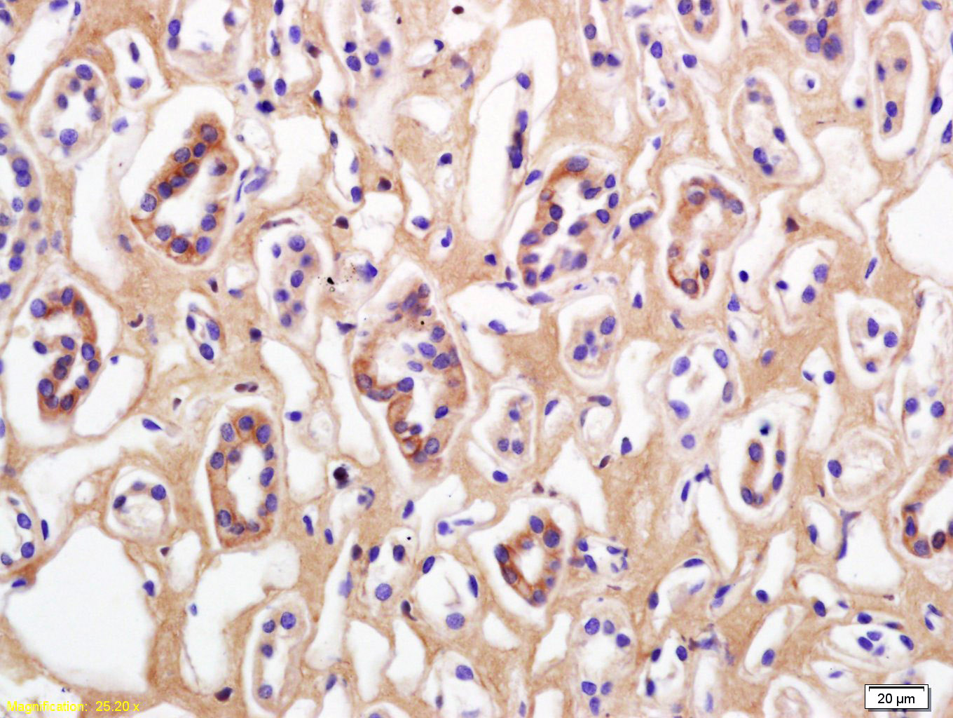 Rabbit anti-Phospho-β Catenin(Thr41+Ser45) Polyclonal Antibody