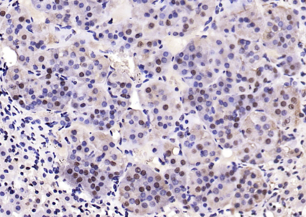 Rabbit anti-Phospho-PTEN(Ser380+Thr382+Thr383) Polyclonal Antibody